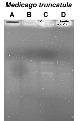 glutamate dehydrogenase vecteur clonage phage lambda gt11 extraction purification ARN totaux synthese premier second brin ADNc insert encapsidation recombinant transfection coli LE392 criblage titre banque sonde radioactive biochimej