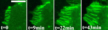 croissance contact communication adhesion cellule matrice extra cellulaire matrix adherens jonction gap tight junction cytosquelette catenin cadherin integrin desmosome immunoglobulin biochimej