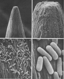 Escherichia Coli microscope cellule organite compartiment noyau mitochondrie virus cellule cell homme procaryote eucaryote prokaryote eukaryote endosymbiose biochimej