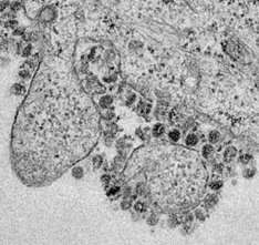 COVID-19 2019-nCoV virus infection bacterie bacteria enveloppe enveloped retrovirus coronavirus nCov SRAS SARS influenza grippe flu ebola biochimej
