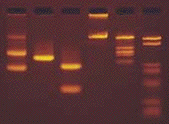 visualisation revelation fluorescence bande bromure d'ethidium necessite Helice ADN intercalation bromure ethidium BET electrophorese electrophoresis biochimej